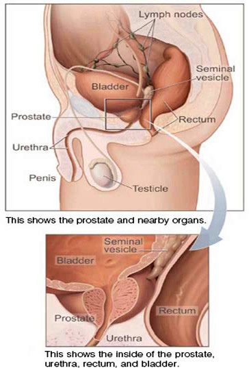 prostate image